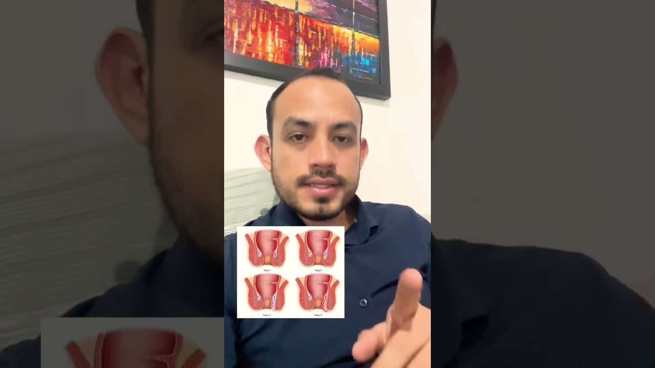 Crema Para Hemorroides Venezuela